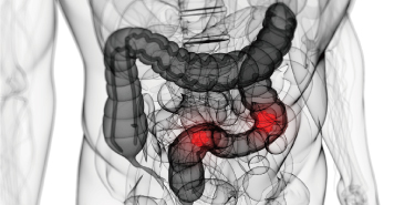 �����׹� Ŭ����